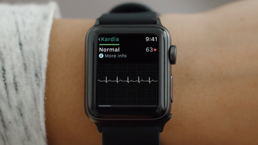 OpenGraph image for arstechnica.com/gadgets/2017/11/fda-approves-first-medical-accessory-for-the-apple-watch-an-ekg-sensor/?amp=1