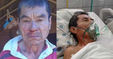 OpenGraph image for eldeber.com.bo/santa-cruz/el-conflicto-por-la-tierra-en-san-ignacio-cobra-su-primera-victima-muere-el-chiquitano-que-fue-agred_241403