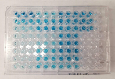 OpenGraph image for en.wikipedia.org/wiki/ELISA