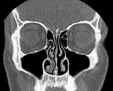 OpenGraph image for en.wikipedia.org/wiki/Nasal_cycle