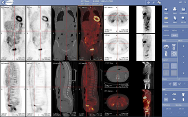 OpenGraph image for en.wikipedia.org/wiki/Nuclear_medicine