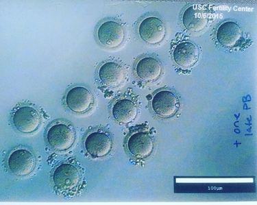 OpenGraph image for medium.com/@corbett/clocking-in-one-scientist-s-decision-to-freeze-her-eggs-the-logistics-3-3-f585da464edd