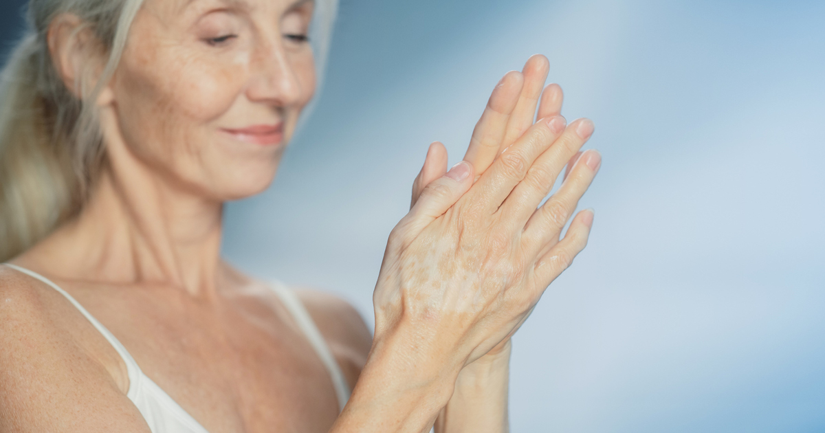 How to Combat Dry Skin from Hypothyroidism