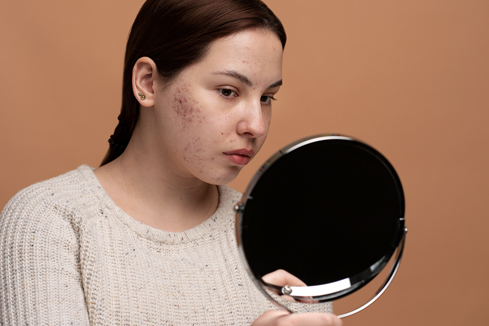 Understanding How The Menstrual Cycle Affects Your Skin