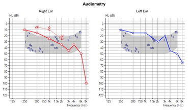 OpenGraph image for remysharp.com/2024/07/05/say-what-on-tinnitus-and-hearing