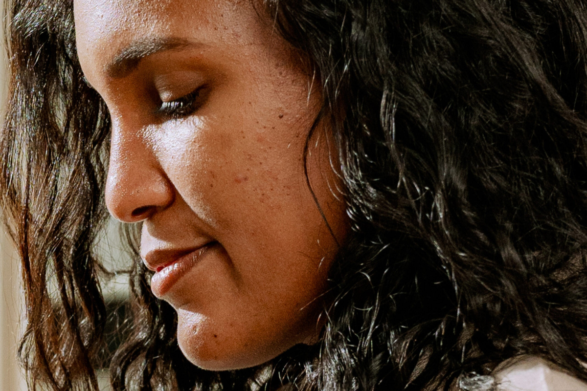 PCOS Acne: Effective Treatments & Solutions - Mira Fertility Tracker