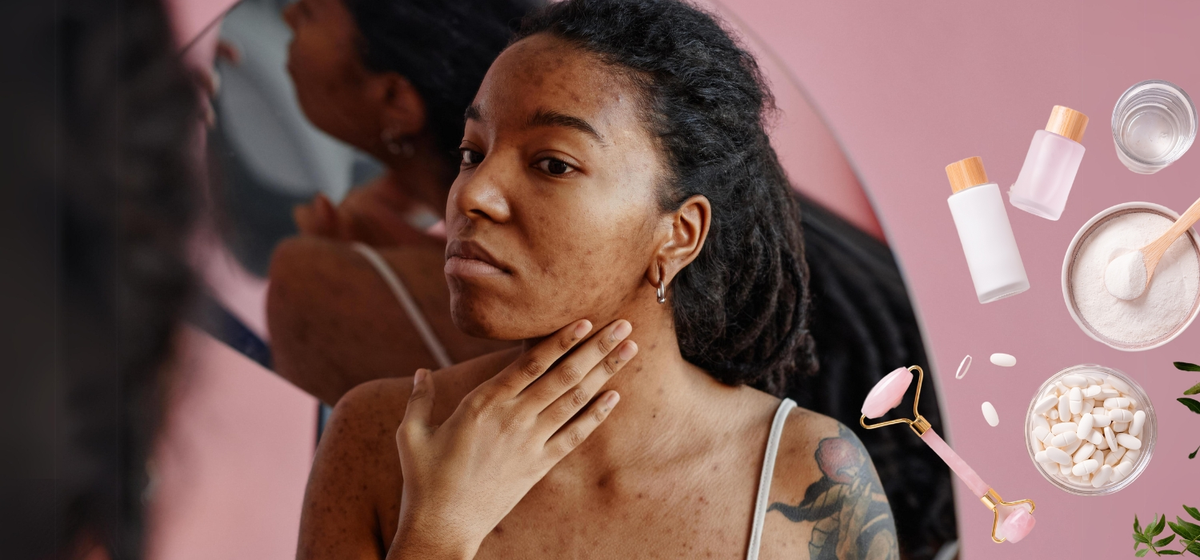 PCOS Skincare Routine | 5 Pointers That Actually Work