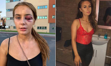 OpenGraph image for trib.al/MRZpCls