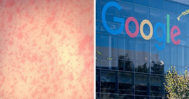 OpenGraph image for buzzfeednews.com/article/stephaniemlee/measles-google-headquarters-mountain-view