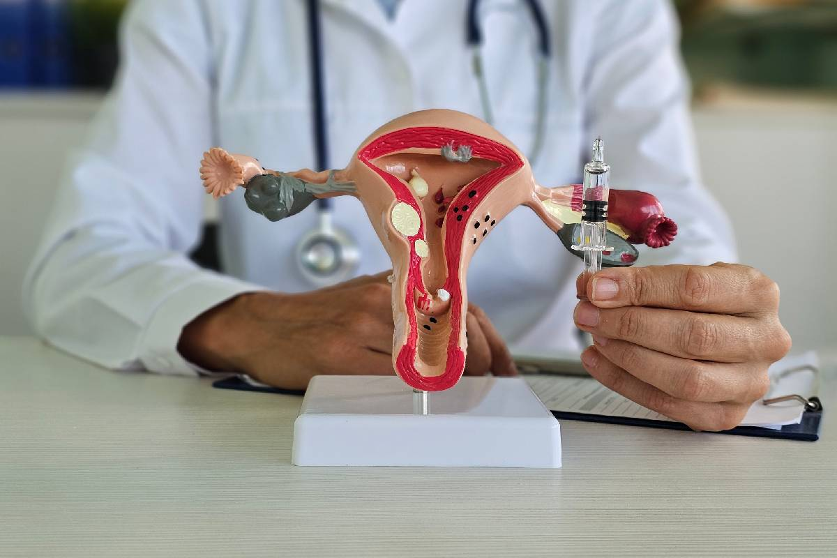 The Connection Between PCOS and Insulin Resistance