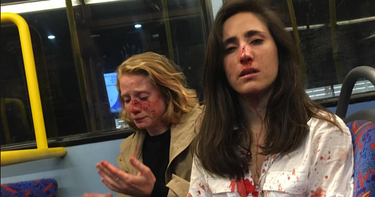 OpenGraph image for cbsnews.com/news/bus-attack-london-lesbian-couple-united-kingdom-homophobia-melania-geymonat-teens-arrested-today-2019-06-07/