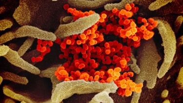 OpenGraph image for cnn.com/world/live-news/coronavirus-pandemic-09-03-20-intl/h_dbf936ede25c392d70a6f6c7dd688f0f