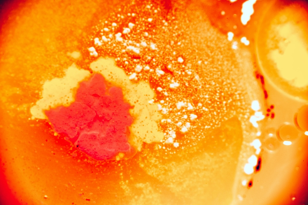 Menstrual Cycle Skin Changes - Dr. Alexis Granite