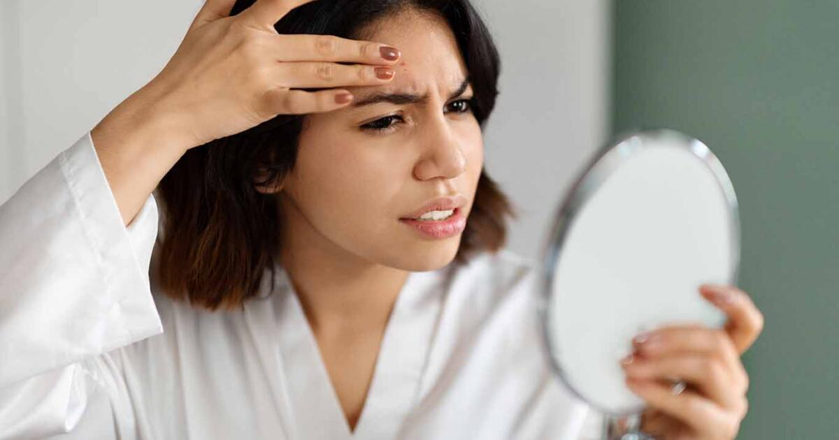 Cortisol and Your Skin: Stress Triggers Breakouts & Aging