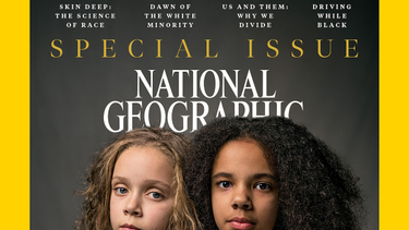 OpenGraph image for nationalgeographic.com/magazine/2018/04/race-twins-black-white-biggs/