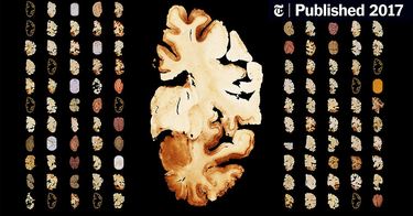 OpenGraph image for nytimes.com/interactive/2017/07/25/sports/football/nfl-cte.html