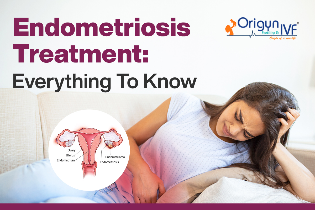 Endometriosis Treatment: The Ultimate Guide For 2025 - Origyn IVF