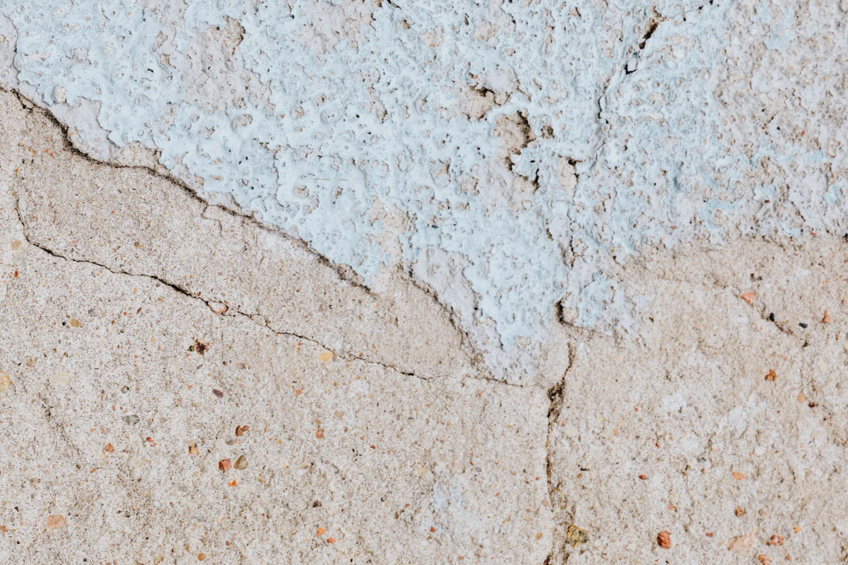 How to Relieve Dry Skin From Hypothyroidism