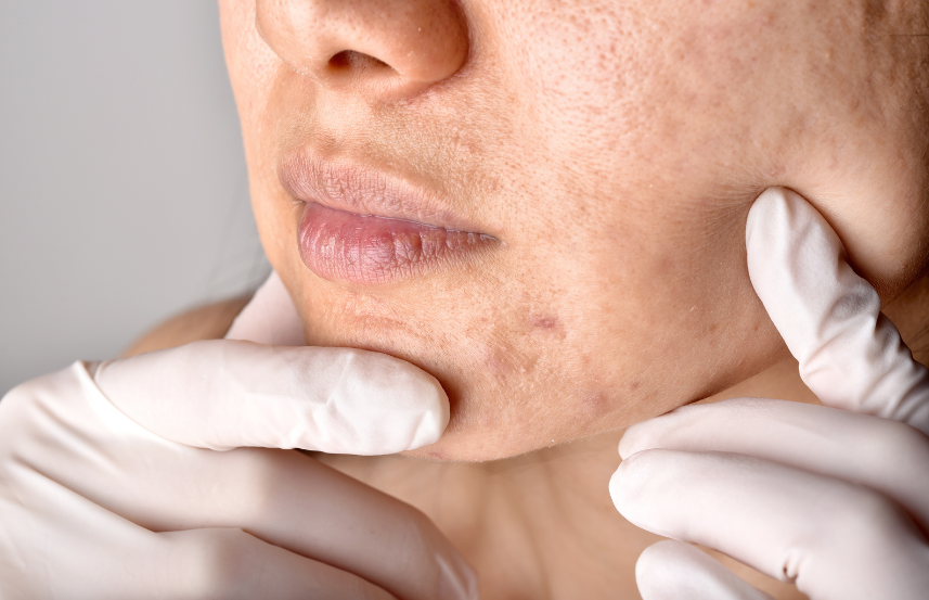 Glowing skin against the odds