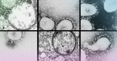 OpenGraph image for theatlantic.com/health/archive/2021/02/coronavirus-pandemic-brazil-variant/617891/