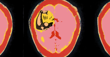 OpenGraph image for theatlantic.com/magazine/archive/2017/07/power-causes-brain-damage/528711/