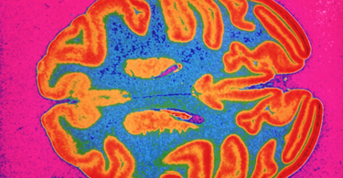 OpenGraph image for theatlantic.com/science/archive/2018/06/there-is-no-biological-difference-between-male-and-female-brains/563702/