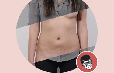 OpenGraph image for vice.com/amp/en_us/article/kzm59x/deepnude-app-creates-fake-nudes-of-any-woman?__twitter_impression=true