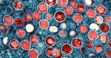 OpenGraph image for voanews.com/a/who-renames-monkeypox-as-mpox-citing-racism-concerns/6854303.html