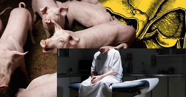OpenGraph image for wired.com/story/capitalist-trap-pig-organ-transplants/