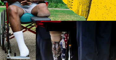 OpenGraph image for wired.com/story/disability-justice-prosthetics-military-history/