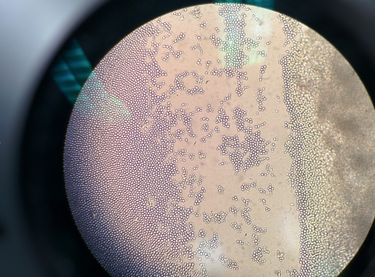 OpenGraph image for wnycstudios.org/podcasts/radiolab/articles/fungus-amungus