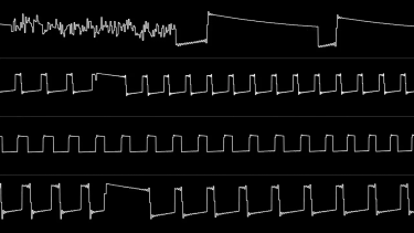 OpenGraph image for youtube.com/watch?v=K66HOo_vEbQ