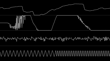 OpenGraph image for youtube.com/watch?v=WOwLfuLPojg