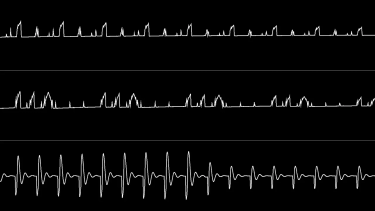 OpenGraph image for youtube.com/watch?v=mqfd1sD4oFA